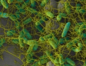 BIOFILM VÀ CÁC VÙNG “Ổ VI KHUẨN” ẨN TRONG NHÀ TẰM
